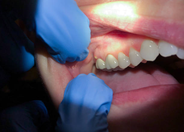 Best Same-Day Emergency Dental Services in Hamburg, AR